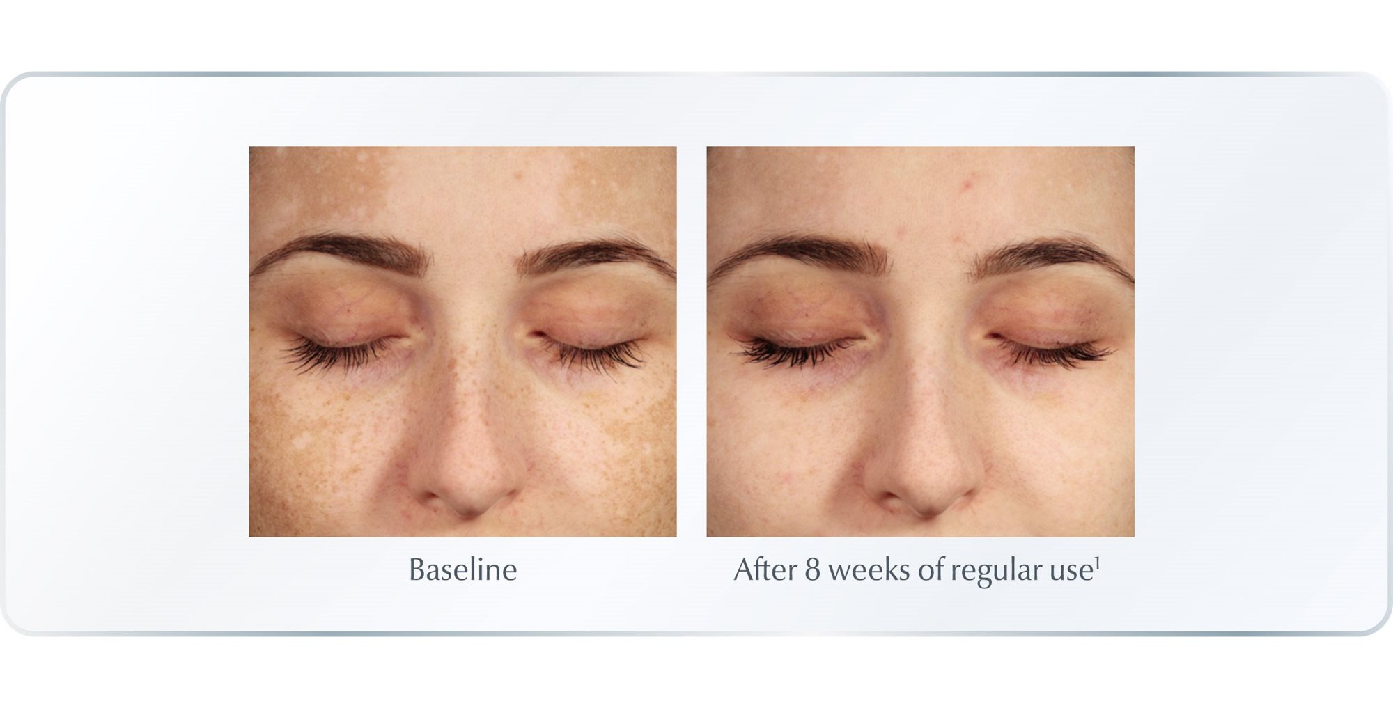 Our research Behind the science of AntiPigment Eucerin