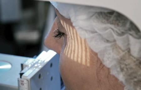Woman´s wrinkles get tested with the PRIMOS method
