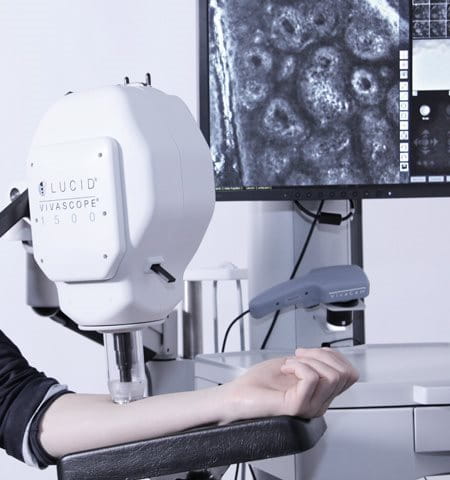 Kobiece ramię badane za pomocą laserowego mikroskopu konfokalnego (CLMS)
