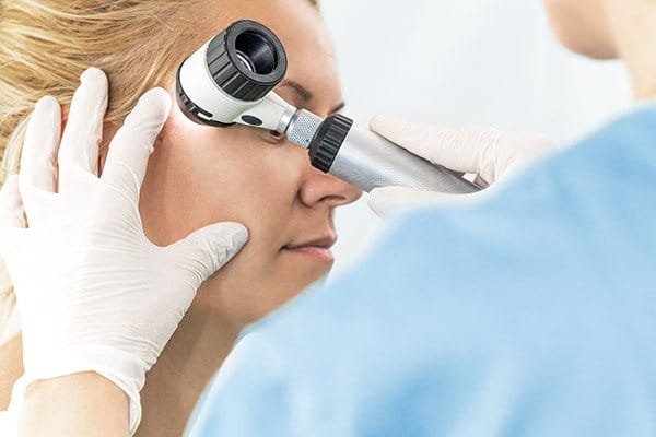 Dermatolodzy badają skórę przed zaleceniem terapii laserowej 