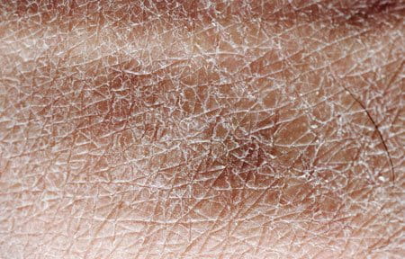 Вътрешните и външните фактори могат да нарушат нивото на хидратация в кожата и да доведат до много изтощена кожа. 