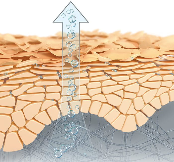A deficiency of water-binding Natural Moisturising Factors (NMFs) leaves the upper layers of the skin dehydrated.
