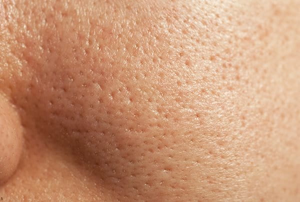 uvećani prikaz pora na nasnoj koži