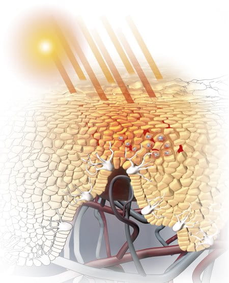 Illustration of sun exposure