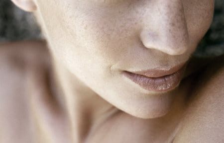 Freckles often appear on the face.