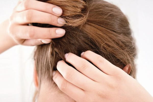 Frau kratzt sich die juckende und trockene Kopfhaut