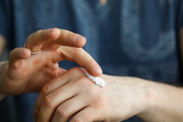 Hände eines Mannes, der Creme auf seinem Handrücken verteilt