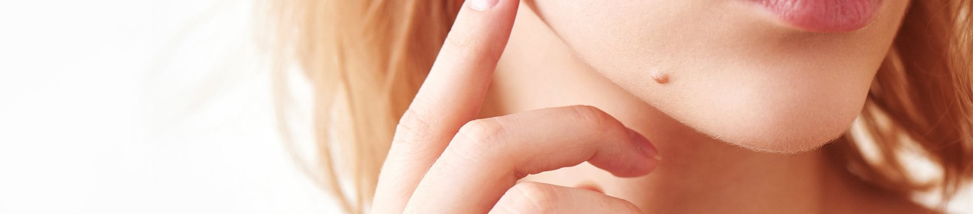 Muttermale und Leberflecken im Gesicht beobachten