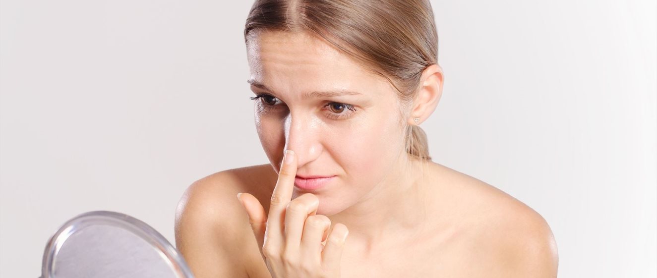 Mitesser treten oft auf der Nase auf