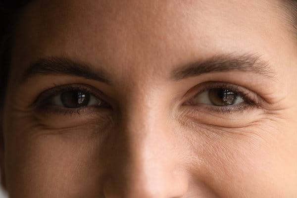 Gesicht einer jungen Frau mit Lachfalten um die Augenpartie