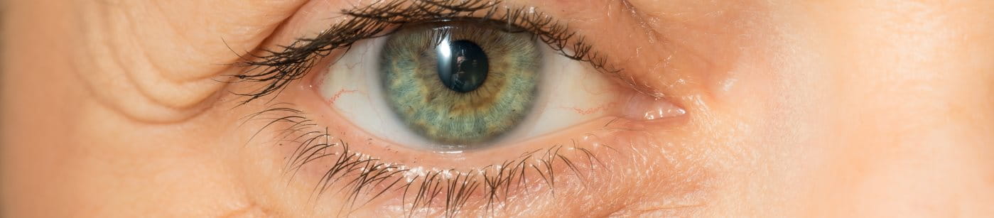 Frau mit Tränensack