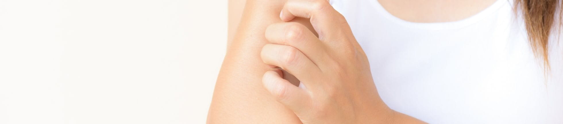 Frau kratzt sich aufgrund von einer allergischen Reaktion der Haut am Arm