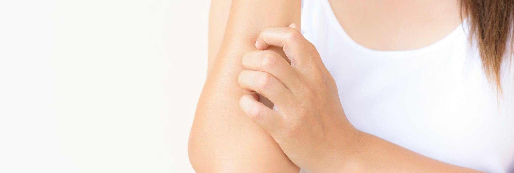 Frau kratzt sich aufgrund von einer allergischen Reaktion der Haut am Arm
