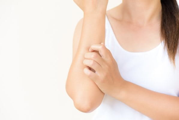Frau kratzt sich am Arm aufgrund einer allergischen Hautreaktion