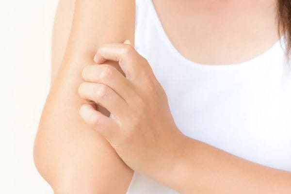 Frau mit Hautirritation kratzt sich am Arm