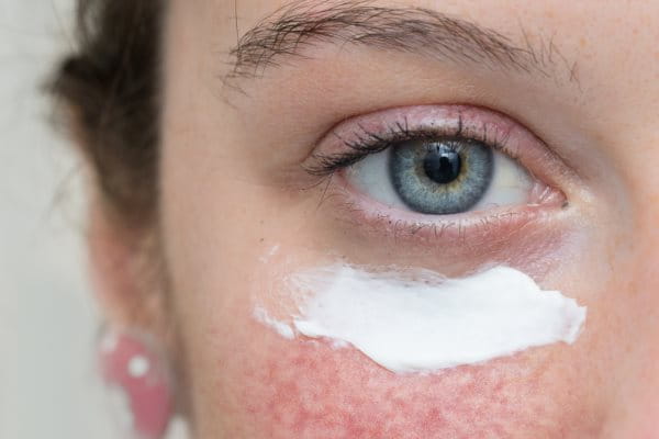 Gesichtsausschnitt einer Frau mit weißer Creme unter dem Auge