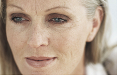 Frau mit sichtbaren Hautveränderungen durch Photoaging