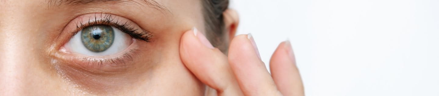 Dunkle Augenringe entstehen oft als Begleiterscheinung von Schlafmangel, Stress oder Erkrankungen. Erfahre hier, was du gegen Augenringe tun kannst.