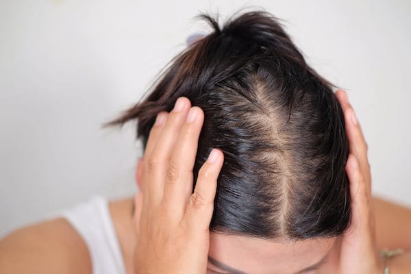 Frau fasst sich mit beiden Händen an den Kopf