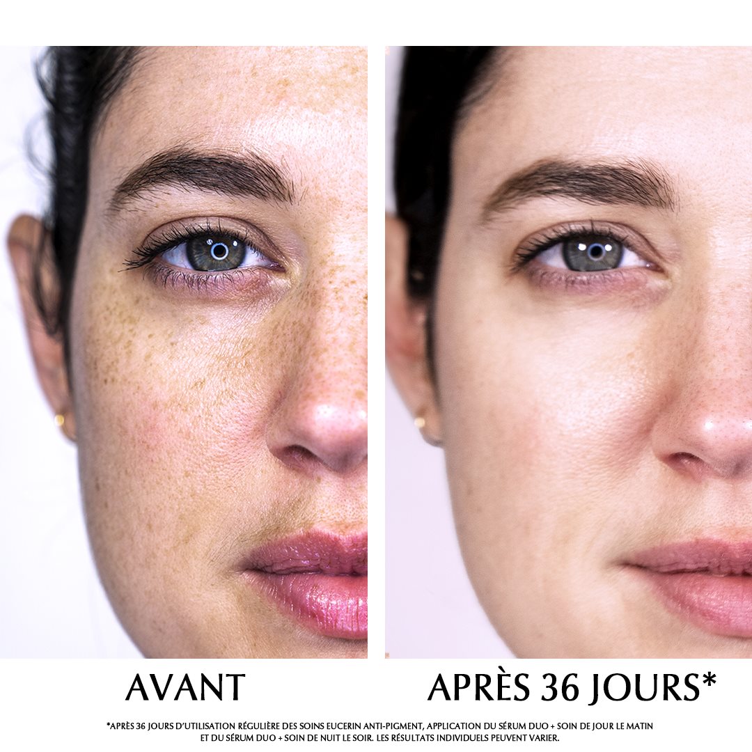 First results of hyperpigmentation reduction are visible in just 12 weeks, showing a reduction of -75%.