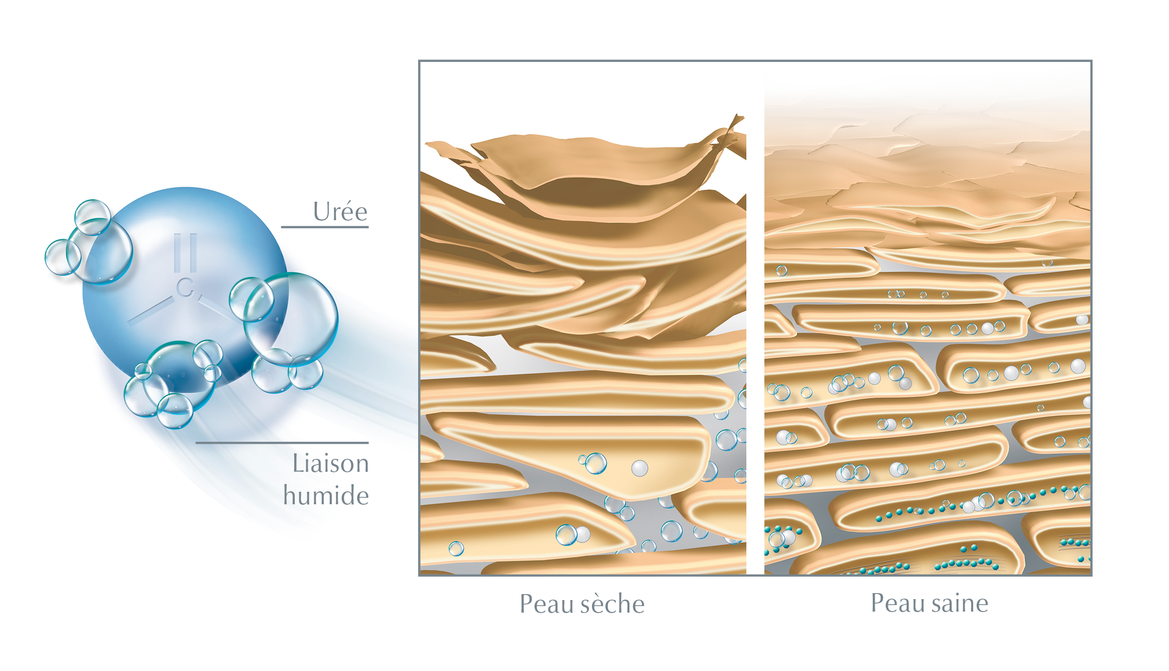 L'urée lie l'eau dans les couches superficielles de la peau et, en même temps, rompt les connexions entre les cellules mortes de la peau - ce qui favorise la desquamation et assure une surface de peau plus lisse.