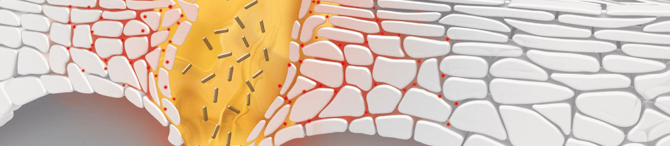 Acné et imperfections