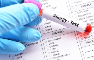 alergije