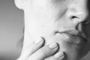 Dealing with acne mark