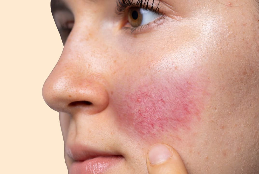 āđāļĢāļāđāļāđāļāđāļāļīāļĢāđāļĄ