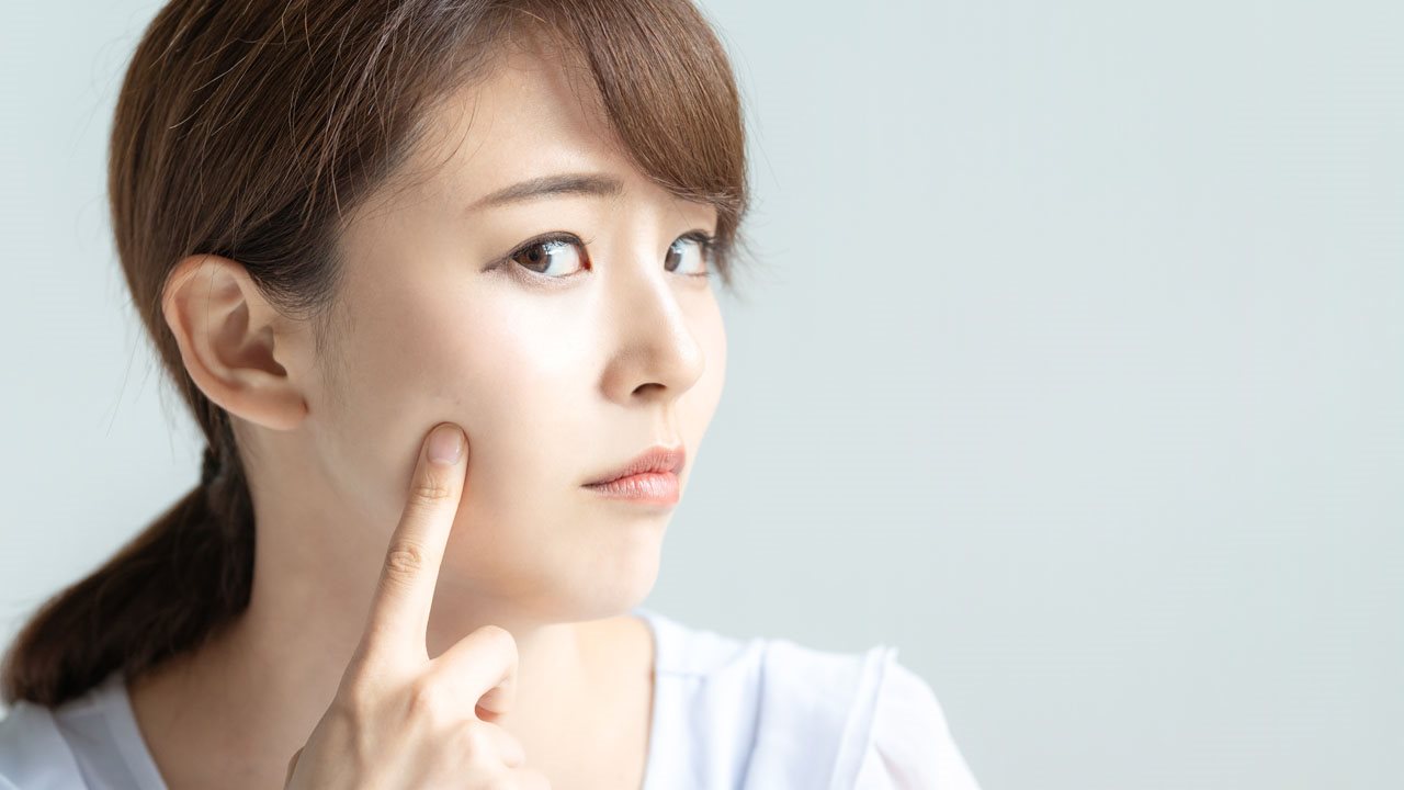 สิวผดที่แก้ม