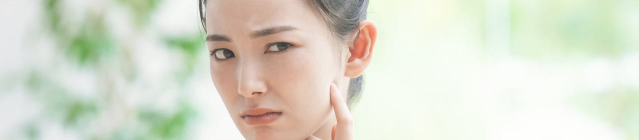 สิวสเตียรอยด์