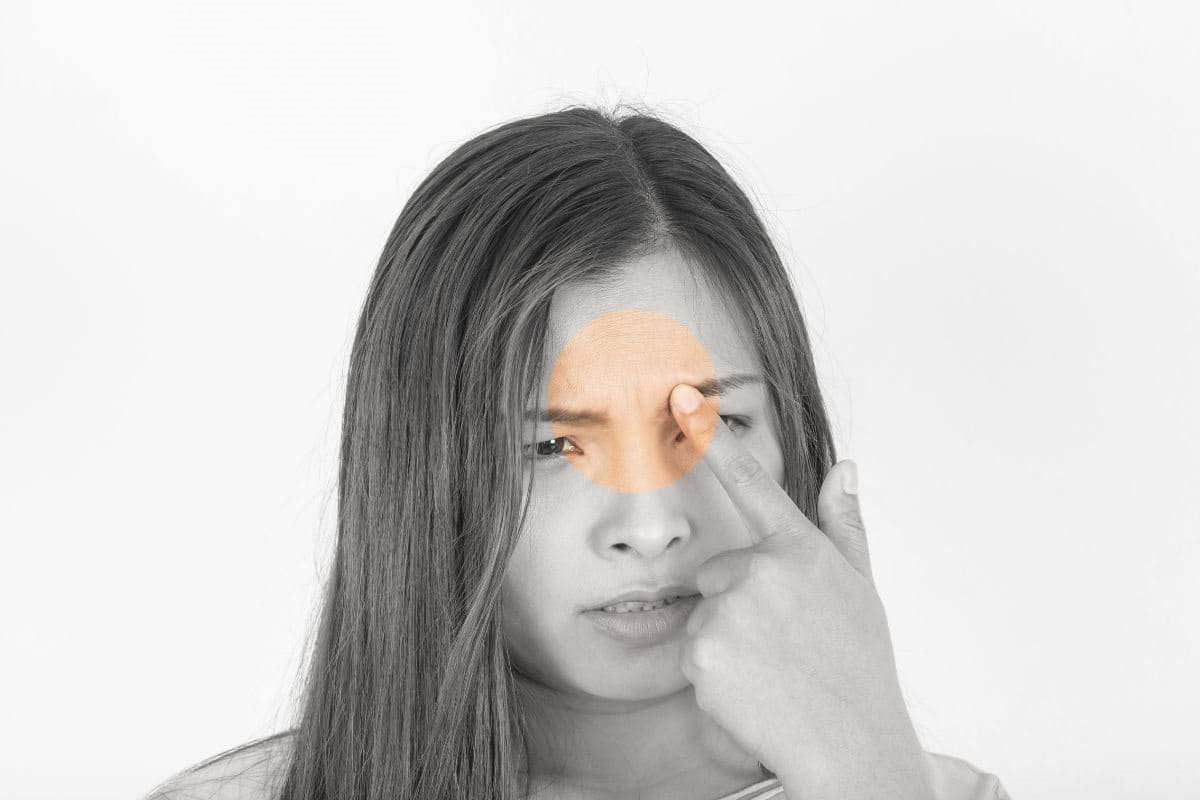 สิว ขึ้น ระหว่าง คิ้ว