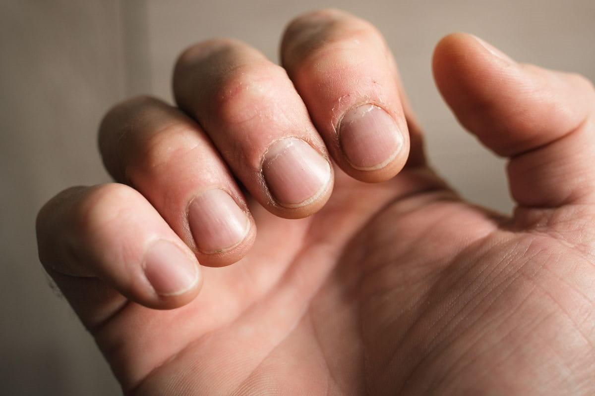  เล็บ เป็น คลื่น