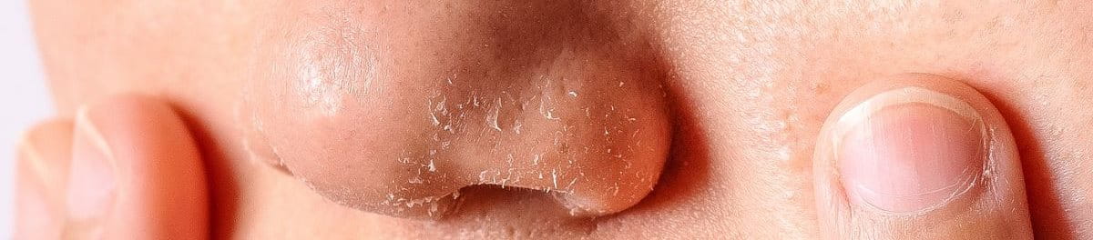 จมูก ลอก