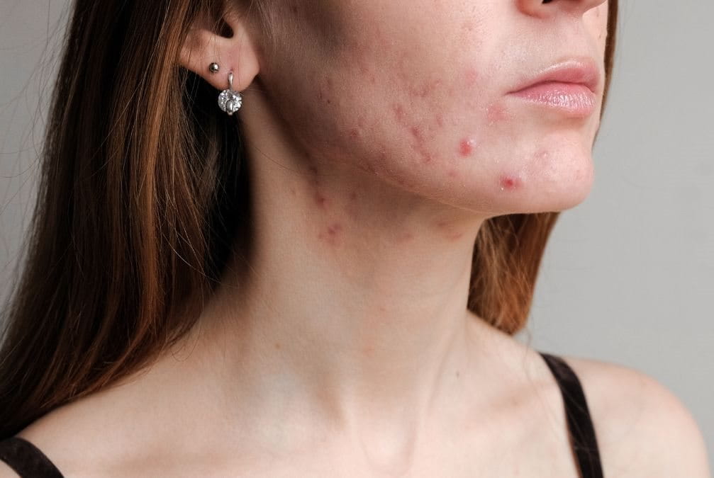 āļŪāļāļĢāđāđāļĄāļ