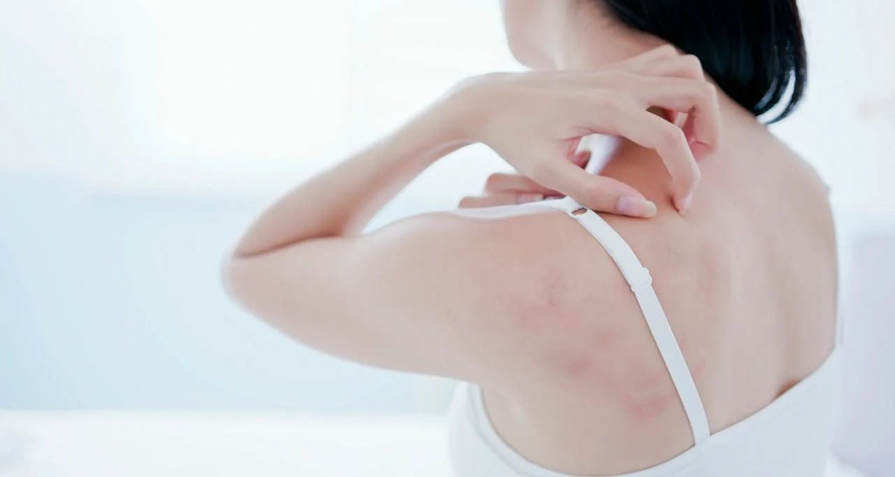 อาการคันจากโรคเชื้อรา