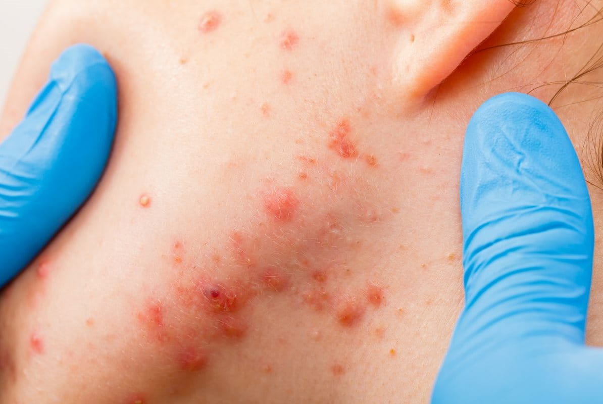 āļŠāļīāļ§āļāļķāđāļāļāļĢāļāļāļŦāļāđāļē