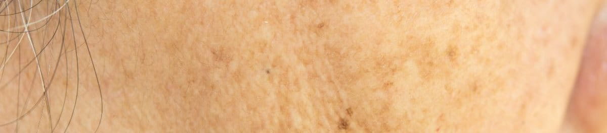 กระเนื้อ