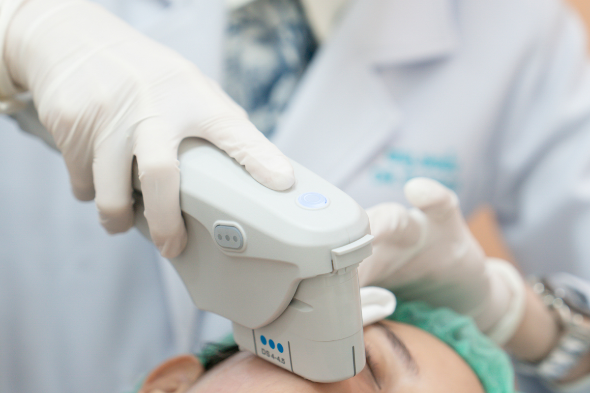 Ultherapy