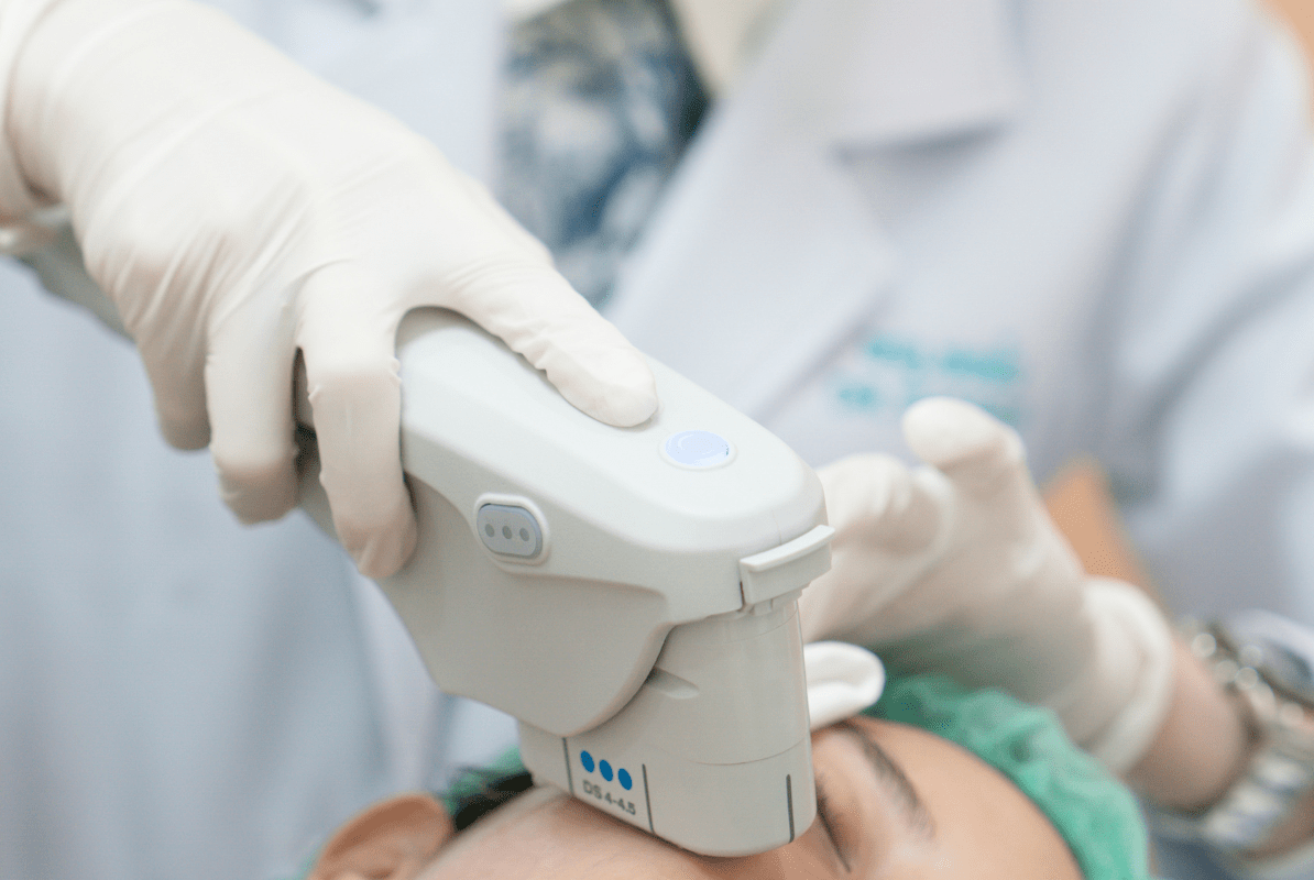 Ultherapy