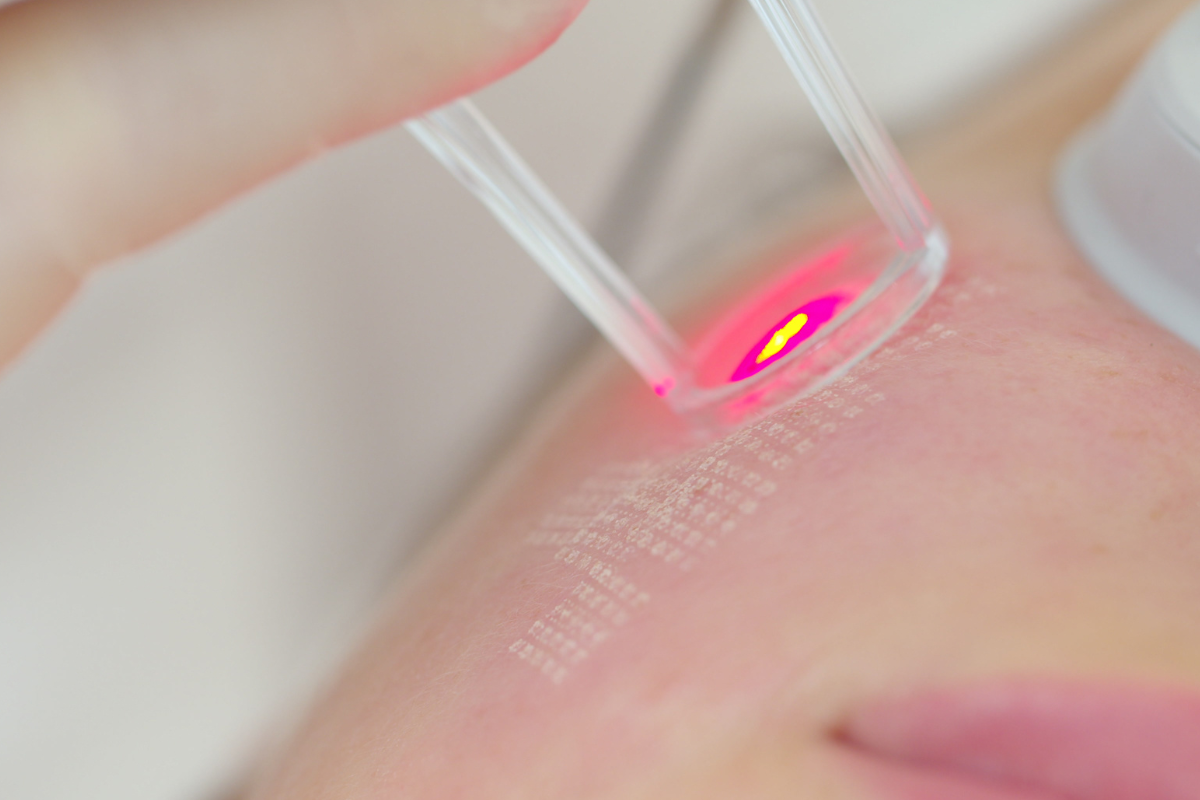 Pico laser