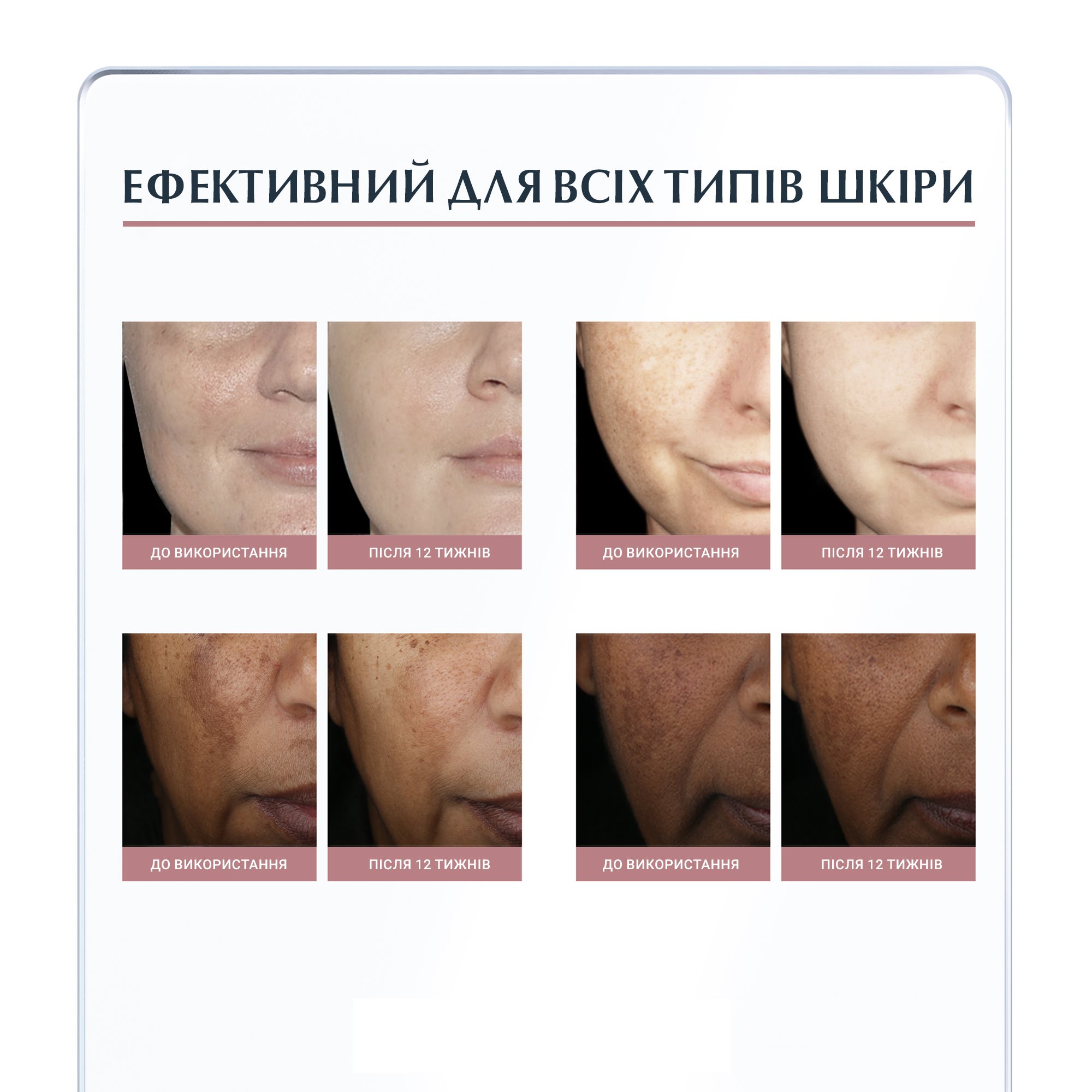 Anti-Pigment Денний депігментуючий крем для обличчя з  SPF30