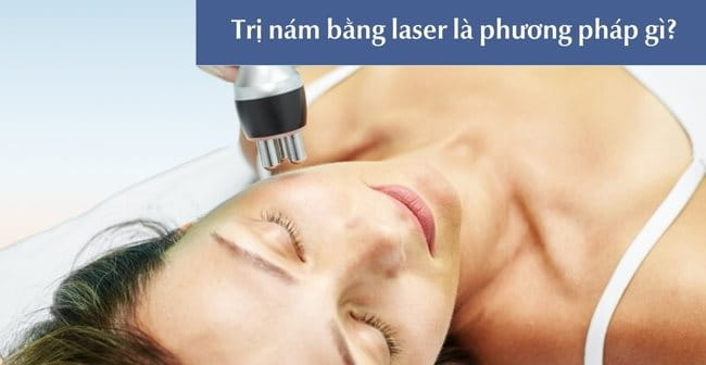 Trị nám bằng laser là gì?