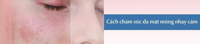 Cách chăm sóc da mặt mỏng nhạy cảm giúp phục hồi da mặt bị mỏng khỏi tổn thương