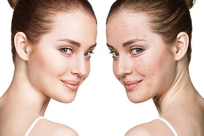 Chăm sóc da mặt trắng mịn hiệu quả với AHA
