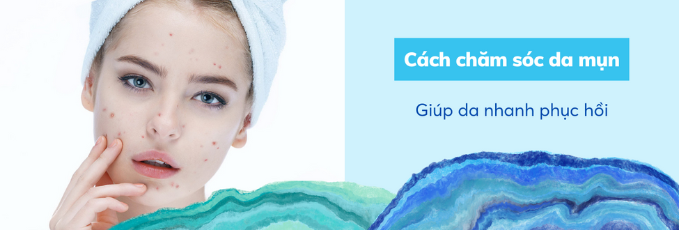 cách chăm sóc da mụn