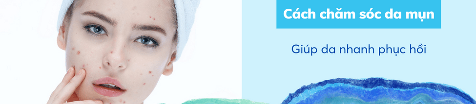 cách chăm sóc da mụn
