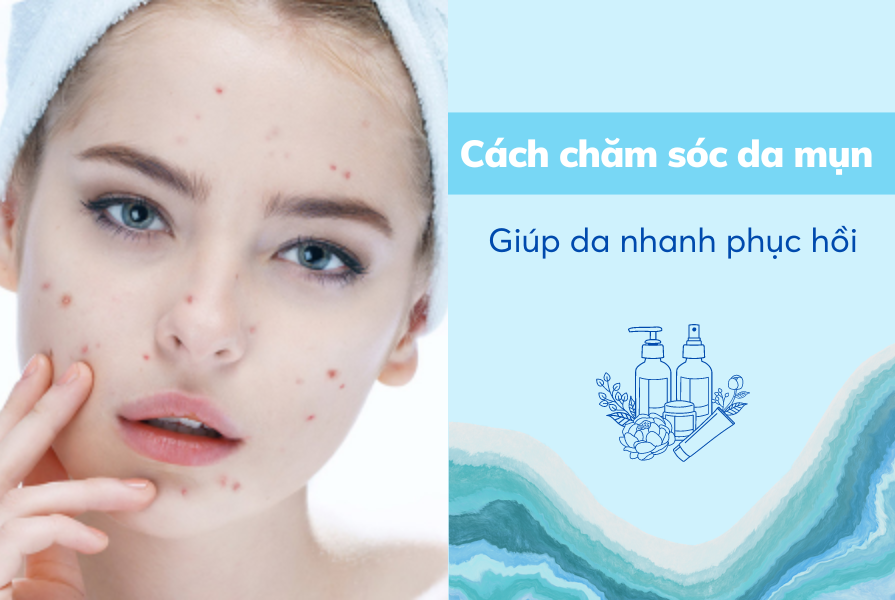 cách chăm sóc da mụn