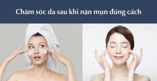 Chăm sóc da mặt sau khi nặn mụn