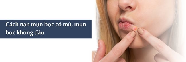 Cách nặn mụn bọc có mủ tránh thâm sẹo